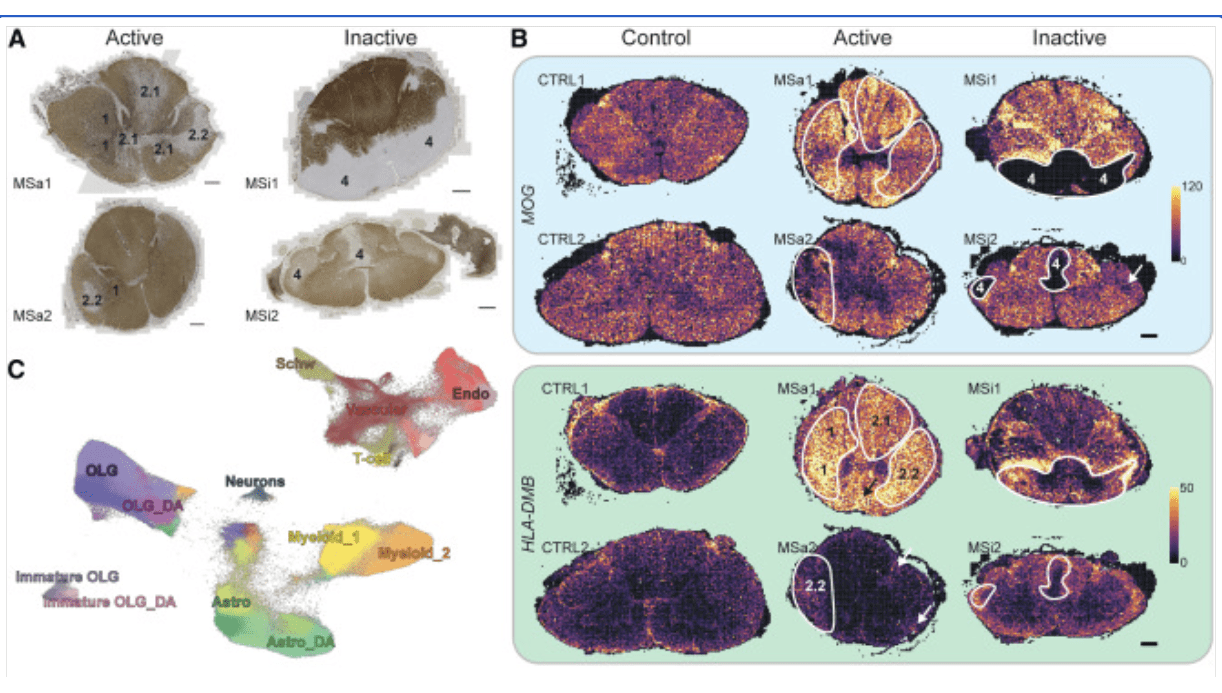 Spatial Transcriptomics & Spatial Biology | 10x Genomics